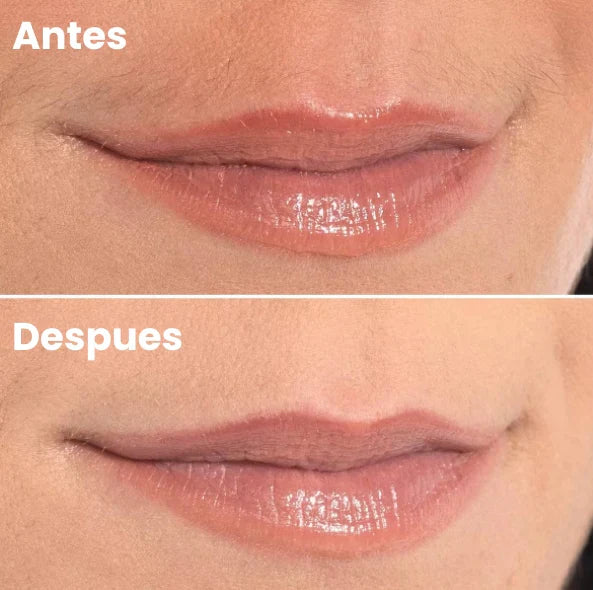 Depiladora Portatil